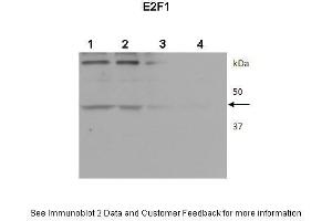 Lanes:  1. (E2F1 Antikörper  (Middle Region))