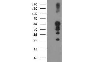 Western Blotting (WB) image for anti-Protein tyrosine Phosphatase, Non-Receptor Type 1 (PTPN1) antibody (ABIN1500495) (PTPN1 Antikörper)