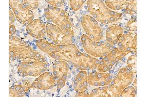 ABIN6258515 and ABIN6274734 at 1/100 staining Rat kidney tissue by IHC-P. (MRPL20 Antikörper  (C-Term))