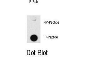 Image no. 1 for anti-SMAD Family Member 4 (SMAD4) (pThr277) antibody (ABIN358227) (SMAD4 Antikörper  (pThr277))