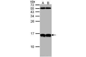 WB Image Sample (30 ug of whole cell lysate) A: HeLa B: Hep G2 , 12% SDS PAGE antibody diluted at 1:1000 (NHP2L1 Antikörper  (full length))