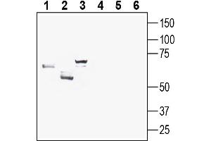 Western blot analysis of rat brain membranes (lanes 1 and 4), mouse liver membranes (lanes 2 and 5) and mouse testis membranes (lanes 3 and 6):1-3.