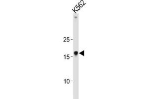 Western Blotting (WB) image for anti-High Mobility Group AT-Hook 1 (HMGA1) antibody (ABIN3004034) (HMGA1 Antikörper)