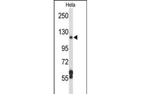 DPP8 Antikörper  (N-Term)