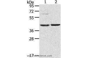 Western blot analysis of Mouse brain and liver tissue, using HIF1AN Polyclonal Antibody at dilution of 1:200 (HIF1AN Antikörper)