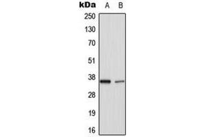 Western blot analysis of TNFAIP1 expression in HuvEC (A), rat lung (B) whole cell lysates. (TNFAIP1 Antikörper  (Center))