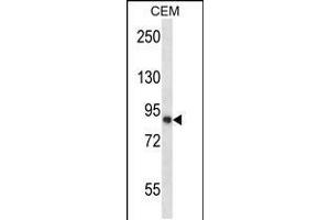 Western blot analysis in CEM cell line lysates (35ug/lane). (CAPN11 Antikörper  (AA 409-438))