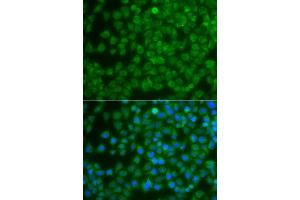 Immunofluorescence analysis of A549 cell using SPIB antibody. (SPIB Antikörper)