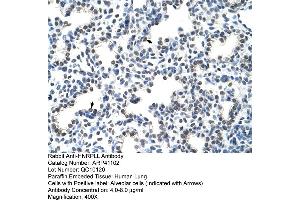 Rabbit Anti-HNRPLL Antibody  Paraffin Embedded Tissue: Human Lung Cellular Data: Alveolar cells Antibody Concentration: 4. (HNRPLL Antikörper  (N-Term))