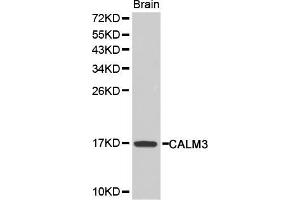 Western blot analysis of extracts of mouse brain, using CALM3 antibody (ABIN5970507). (Calmodulin 3 Antikörper)