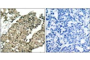 Image no. 3 for anti-GTPase Activating Protein (SH3 Domain) Binding Protein 1 (G3BP1) (pSer232) antibody (ABIN196762)