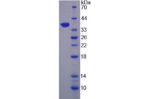 SDS-PAGE (SDS) image for Calpain 9 (CAPN9) (AA 42-340) protein (His tag) (ABIN6239215)