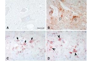 anti-4-Hydroxy-2-Hexenal (4-HHE) antibody