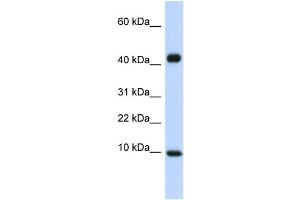 WB Suggested Anti-CCL8 Antibody Titration:  0. (CCL8 Antikörper  (Middle Region))