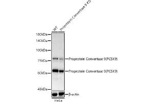 Western blot analysis of extracts of HeLa cells, using Proprotein Convertase 9(PCSK9) antibody  at 1:1000 dilution. (PCSK9 Antikörper)