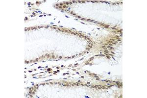 Immunohistochemistry of paraffin-embedded human stomach using PTTG1 antibody at dilution of 1:100 (40x lens). (PTTG1 Antikörper)