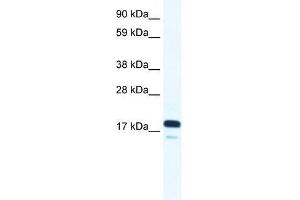 Western Blot showing TAF9 antibody used at a concentration of 1-2 ug/ml to detect its target protein. (TAF9 Antikörper  (N-Term))