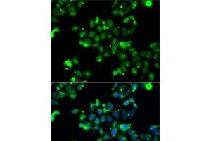 Immunofluorescence analysis of A-549 cells using U2AF1L4 Polyclonal Antibody (Splicing factor U2AF 26 kDa subunit (U2AF1L4) Antikörper)