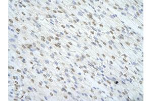 Immunohistochemistry (IHC) image for anti-Splicing Factor 1 (SF1) (N-Term) antibody (ABIN2776691)