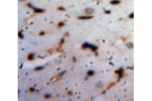 IHC-P analysis of Heart tissue, with DAB staining. (ANGPTL1 Antikörper  (AA 271-491))