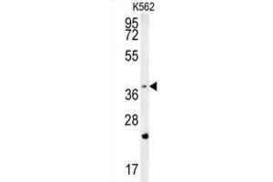 Western Blotting (WB) image for anti-F-Box and WD Repeat Domain Containing 12 (FBXW12) antibody (ABIN2995589) (FBXW12 Antikörper)