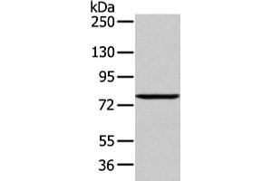Gel: 6 % SDS-PAGE, Lysate: 60 μg, Lane: 293T cell, Primary antibody: ABIN7193043(WDR91 Antibody) at dilution 1/400 dilution, Secondary antibody: Goat anti rabbit IgG at 1/8000 dilution, Exposure time: 1 minute (WDR91 Antikörper)