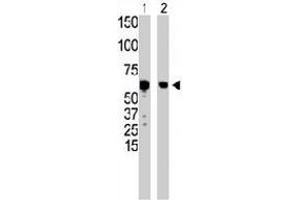The GCK polyclonal antibody  is used in Western blot to detect GCK in HepG2 cell lysate (Lane 1) and mouse liver tissue lysate (Lane 2) . (GCK Antikörper  (N-Term))