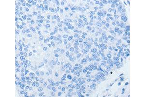 Immunohistochemistry (IHC) image for anti-Endothelin Receptor Type B (EDNRB) antibody (ABIN1872425)