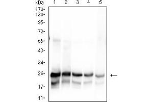 Western blot analysis using SARS-Cov2-NP1 mAb against human SARS-Cov2-N (AA: 1-180) recombinant protein. (SARS-Cov2-NP1 (AA 1-180) Antikörper)