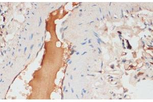Immunohistochemistry of paraffin-embedded Human lung using APOC1 Polyclonal Antibody at dilution of 1:100 (40x lens).