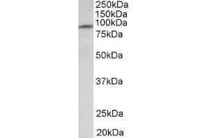 ABIN987283 (1µg/ml) staining of Human Heart lysate (35µg protein in RIPA buffer). (MFSD6 Antikörper  (Internal Region))