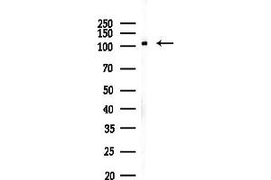anti-Methylenetetrahydrofolate Dehydrogenase (NADP+ Dependent) 1-Like (MTHFD1L) (C-Term) antibody