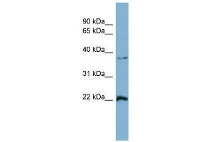 WB Suggested Anti-RAN Antibody Titration: 0.