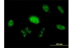 Immunofluorescence of purified MaxPab antibody to PIK3R3 on HeLa cell. (PIK3R3 Antikörper  (AA 1-461))