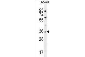 Western Blotting (WB) image for anti-Potassium Channel Subfamily K Member 1 (KCNK1) antibody (ABIN2996574) (KCNK1 Antikörper)