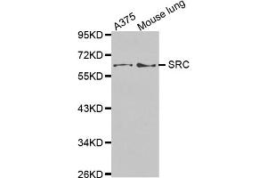Western blot analysis of extracts of various cell lines, using SRC antibody (ABIN5970131). (Src Antikörper)