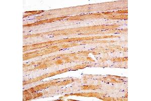 IHC analysis of Presenilin 2/AD5/PSEN2 using anti-Presenilin 2/AD5/PSEN2 antibody (ABIN7602796).