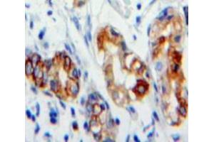 Used in DAB staining on fromalin fixed paraffin-embedded Stomach tissue (CD36 Antikörper  (AA 187-428))