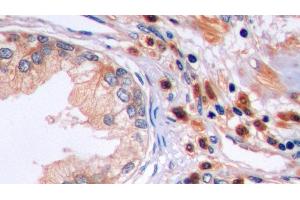 Immunohistochemistry (IHC) image for anti-TNF Receptor Superfamily, Member 6 (FAS) (AA 22-172) antibody (ABIN7437713)