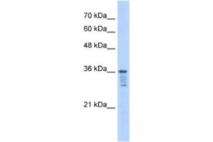 Western Blotting (WB) image for anti-Leucine Zipper Transcription Factor-Like 1 (LZTFL1) antibody (ABIN2463178) (LZTFL1 Antikörper)