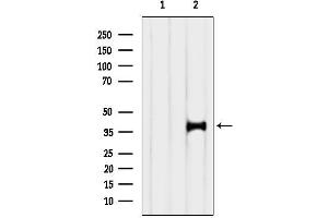 anti-Endophilin-A3 (SH3GL3) (Internal Region) antibody