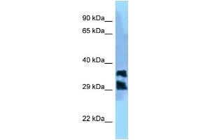 WB Suggested Anti-PGP Antibody Titration: 1. (PGP Antikörper  (C-Term))