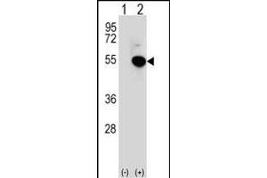 Western blot analysis of IRF4 (arrow) using rabbit polyclonal IRF4 Antibody (Center) (ABIN656568 and ABIN2845828). (IRF4 Antikörper  (AA 164-191))