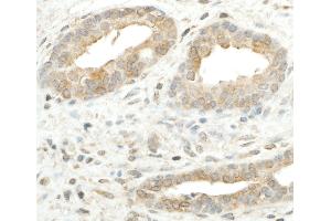 Immunohistochemistry (IHC) image for anti-Ribosomal Protein S5 (RPS5) (AA 1-50) antibody (ABIN7455001) (RPS5 Antikörper  (AA 1-50))
