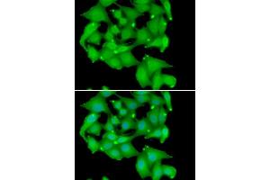 Immunofluorescence analysis of A549 cells using PRKD3 antibody (ABIN5974259).