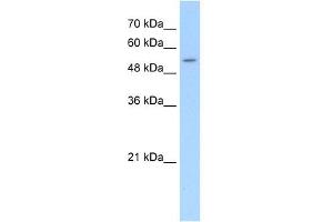 SLC26A8 antibody used at 5 ug/ml to detect target protein. (SLC26A8 Antikörper  (C-Term))