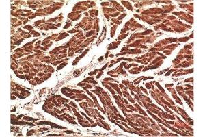 Immunohistochemical analysis of paraffin-embedded Human Heart Tissue using VE-Cadherin Mouse mAb diluted at 1:200. (Cadherin 5 Antikörper  (AA 670-750))