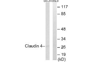 Immunohistochemistry analysis of paraffin-embedded human brain tissue, using Claudin 4 (Ab-208) antibody. (Claudin 4 Antikörper  (Internal Region))