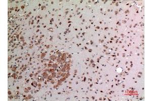 Immunohistochemistry (IHC) analysis of paraffin-embedded Rat Brain, antibody was diluted at 1:100. (FGF20 Antikörper  (Internal Region))