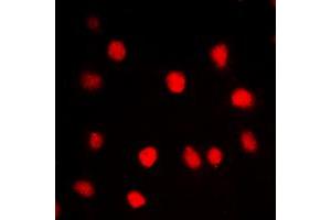 Immunofluorescent analysis of CLK1 staining in HuvEc cells. (CLK1 Antikörper  (Center))